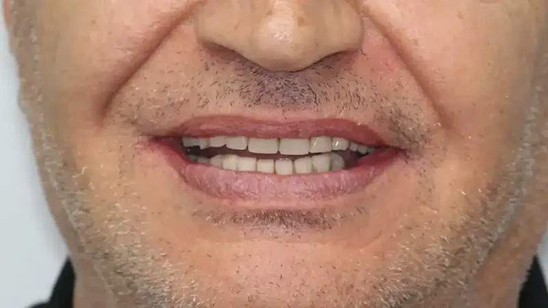 edg upland smilemakeover before 1