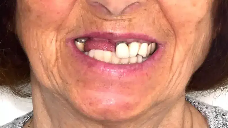 edg upland smilemakeover before 3