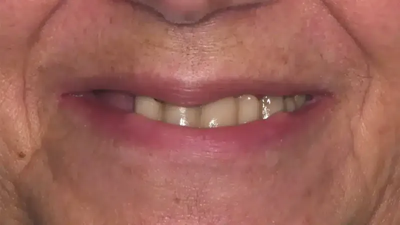 edg upland smilemakeover before 4