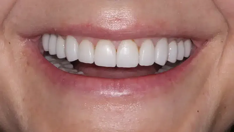 edg upland smilemakeover before 5