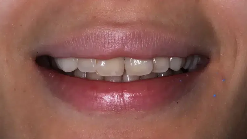 edg upland smilemakeover before 7